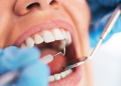 Klinik Dokter Gigi Jakarta Timur: 4 Cara Merawat Gigi dan Manfaatnya untuk Kesehatan