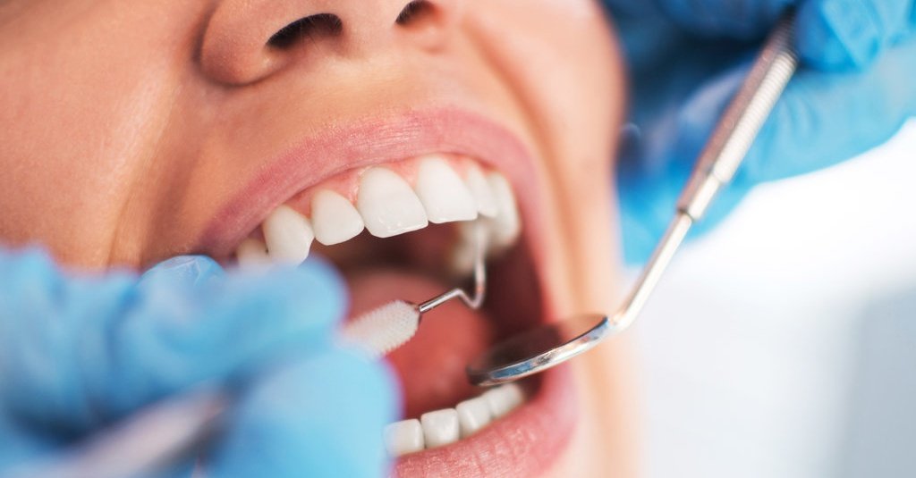 Apa Keuntungan Pergi Ke Klinik Gigi?